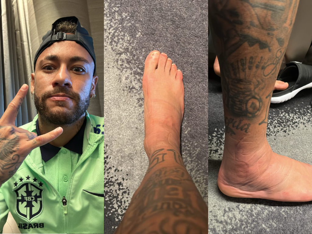 Fora Da Fase De Grupos Da Copa Neymar Posta Foto Do Tornozelo Inchado